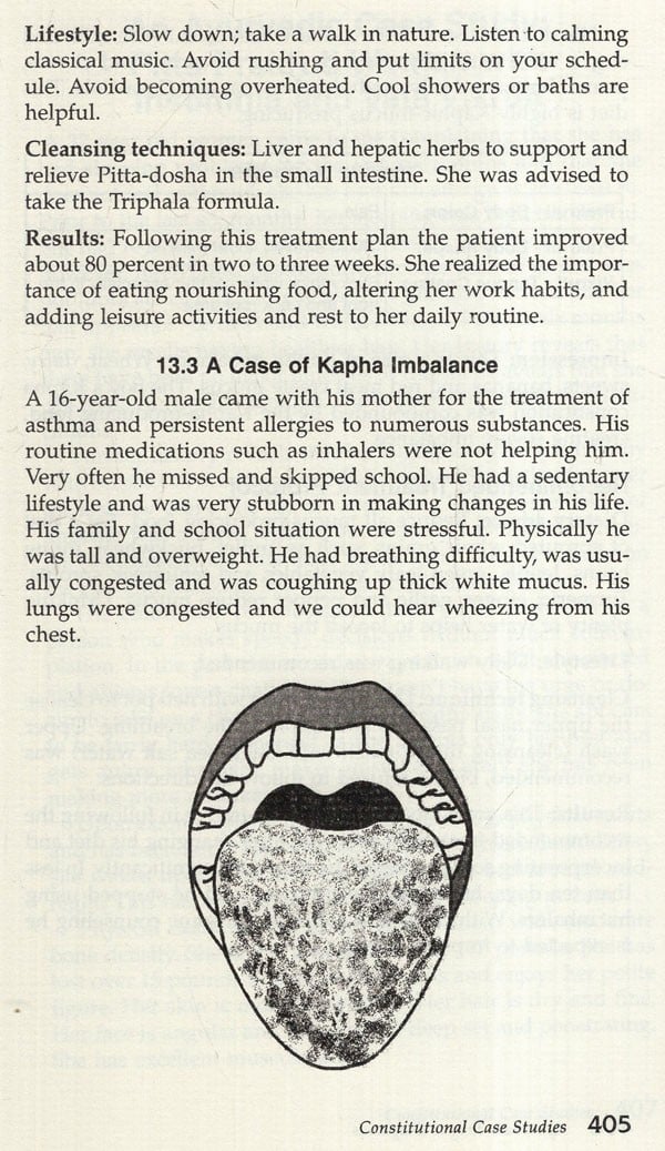 Ayurvedic Tongue Diagnosis Exotic India Art