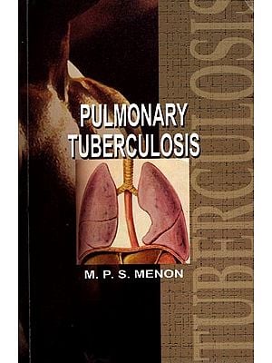 Pulmonary Tuberculosis