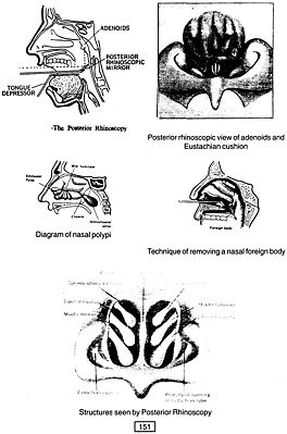 The Shalakya Tantra: Diseases of Eye, Head and E.N.T. (2 Vols. bound in ...