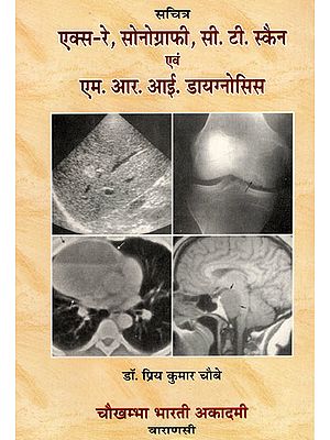 एक्स-रे, सोनोग्राफी, सी.टी. स्कैन एवं एम.आर.आई. डायगनोसिस - X-Ray, Sonography, C.T. Scan & M.R.I. Diagnosis (with Radiographs)
