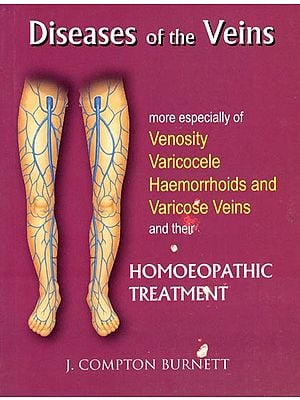 Diseases of The Veins (More Especially of Venosity Varicocele Haemorrhoids and Varicose Veins and Their Homoeopathic Treatment)