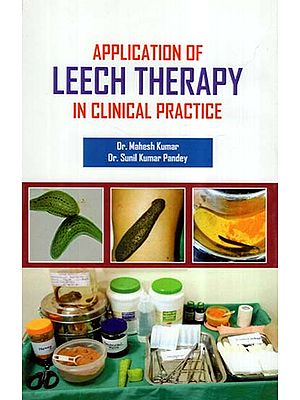 Application Of Leech Therapy In Clinical Practice