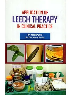 Application Of Leech Therapy In Clinical Practice