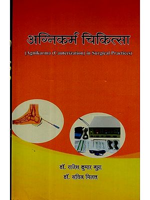 अग्निकर्म चिकित्सा - Agnikarma Cauterization in Surgical Practices