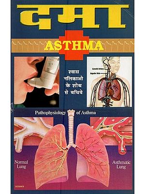 दमा- Asthma