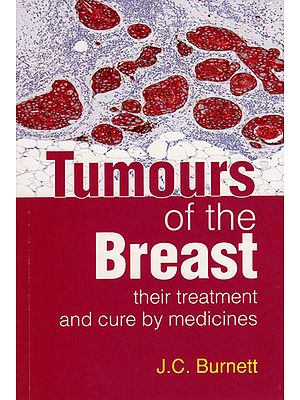 Tumours of the Breast (Their Treatment and Cure by Medicines)