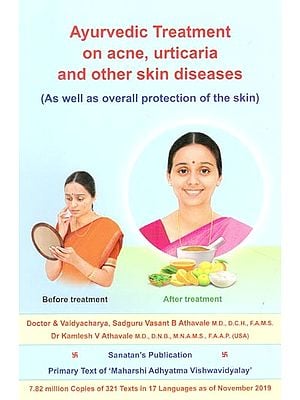 Ayurvedic Treatment On Acne, Urticaria and Other Skin Disease (As Well as Overall Protection of the Skin)