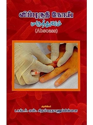 விப்புருதி நோய்  மருத்துவம்- Vibruti Disease Medicine- Abscess (Tamil)