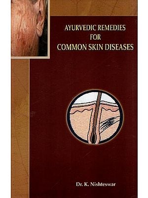 Ayurvedic Remedies for Common Skin Diseases