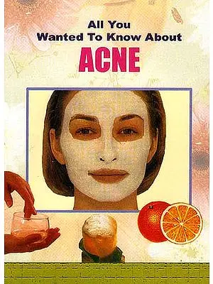 All You Wanted to Know About Acne