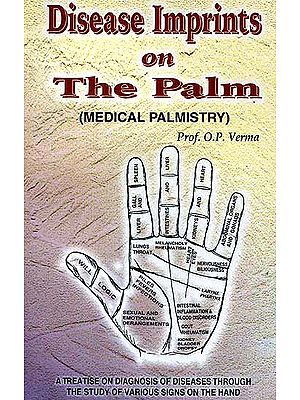 Duplicate of  UAC387