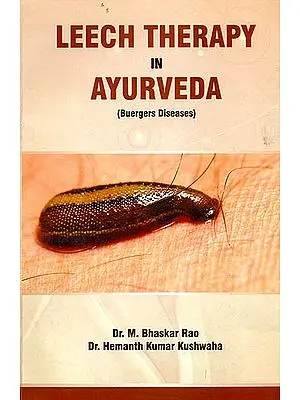 Leech Therapy in Ayurveda (Buergers Diseases)