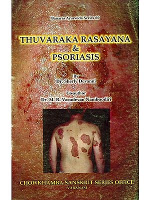Thuvaraka Rasayana and Psoriasis