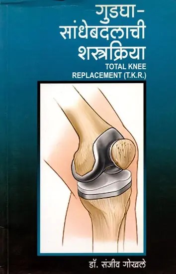 गुडघा सांधेबदलाची शस्त्रक्रिया (रचना, इजा व उपचार सर्वांगीण माहिती): Gudagha Sandhebadalachi Shastrakriya (Rachana, Ija Va Upachar Sarvangin) - Marathi