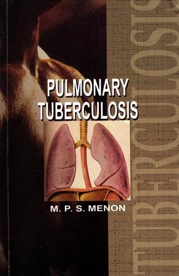 Pulmonary Tuberculosis