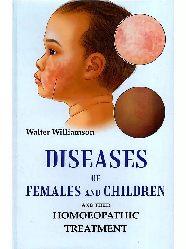 Diseases of Females and Children and their Homoeopathic Treatment