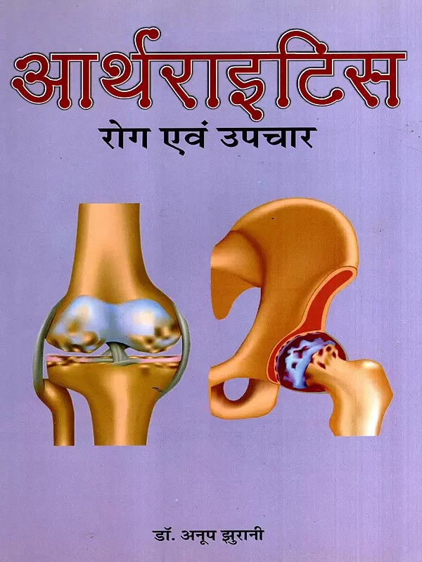 आर्थराइटिस रोग एवं उपचार: Arthritis Disease and Treatment