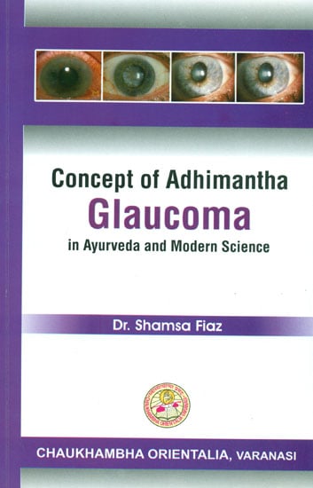 Concept of Adhimantha: Glaucoma in Ayurveda and  Modern Science