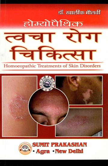 होम्योपैथिक त्वचा रोग चिकित्सा: Homeopathic Treatments of Skin Disorders