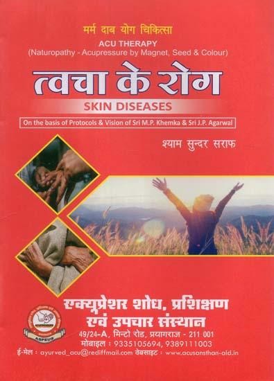 त्वचा के रोग (मर्म दाब योग चिकित्सा)- Skin Diseases (Naturopathy - Acupressure by Magnet, Seed & Colour)