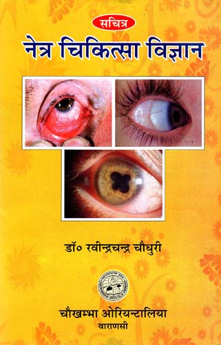 नेत्र चिकित्सा विज्ञान: Ophthalmology