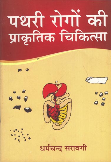 पथरी रोगों की प्राकृतिक चिकित्सा - Naturopathy of Stone Diseases