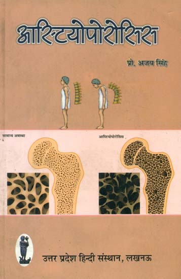 आस्टियोपोरोसिस: Osteoporosis