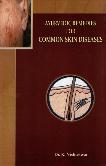 Ayurvedic Remedies for Common Skin Diseases