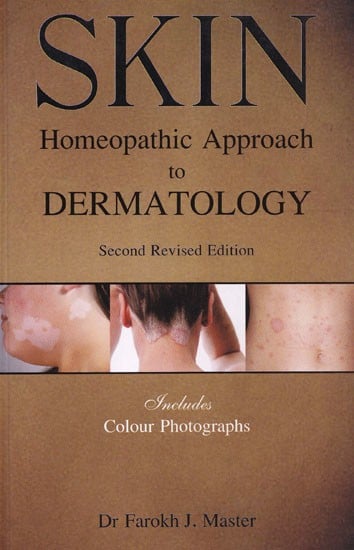 Skin: Homeopathic Approach to Dermatology