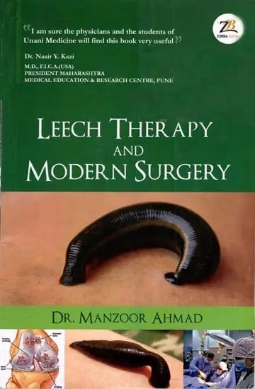Leech Therapy and Modern Surgery