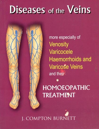 Diseases of The Veins (More Especially of Venosity Varicocele Haemorrhoids and Varicose Veins and Their Homoeopathic Treatment)