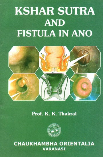 Kshar Sutra and Fistula in Ano
