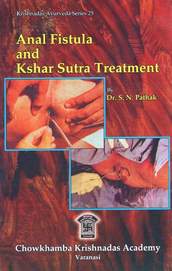 Anal Fistula and Kshar Sutra Treatment