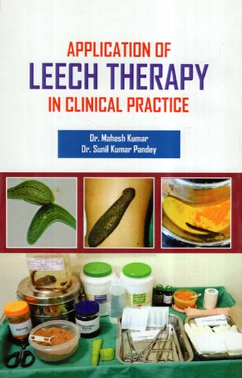 Application Of Leech Therapy In Clinical Practice