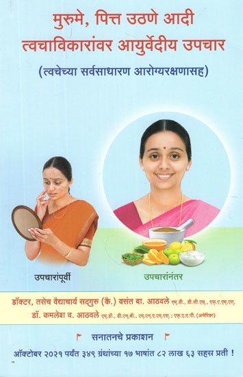 मुरुमे, पित्त उठणे आदी त्वचाविकारांवर आयुर्वेदीय उपचार- Ayurvedic Treatment For Acne, Gallstones Etc (Marathi)