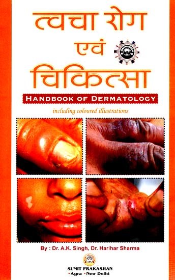 त्वचा रोग एवं चिकित्सा- Handbook of Dermatology (Including Coloured Illustrations)