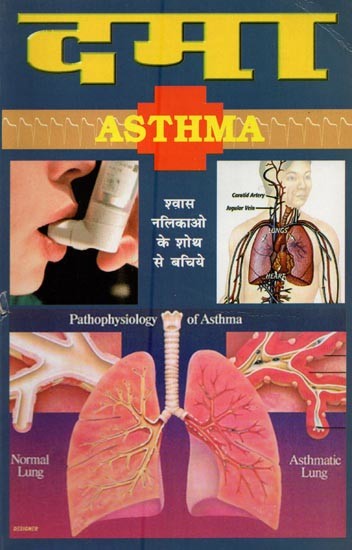दमा- Asthma