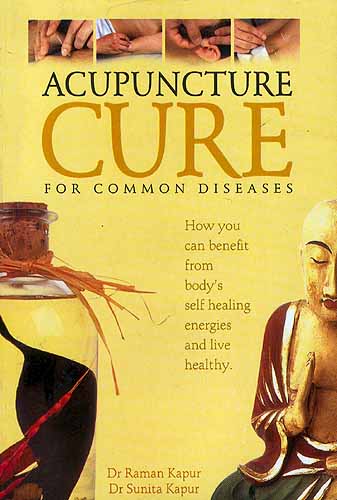 Acupuncture Cure: For Common Diseases