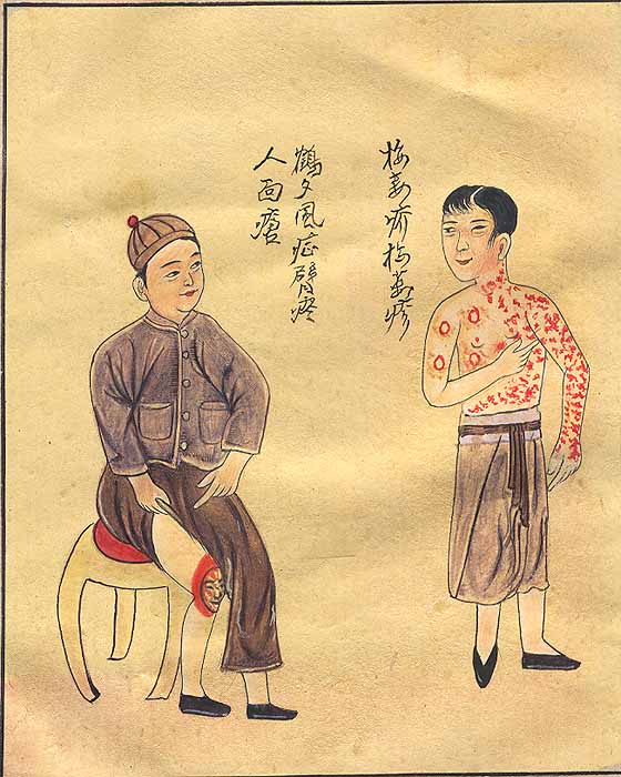 Skin Disease - The Human Face